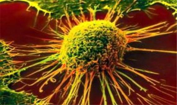 محقق ايراني نقش کورکومين را در کاهش سرطان ريه کشف کرد